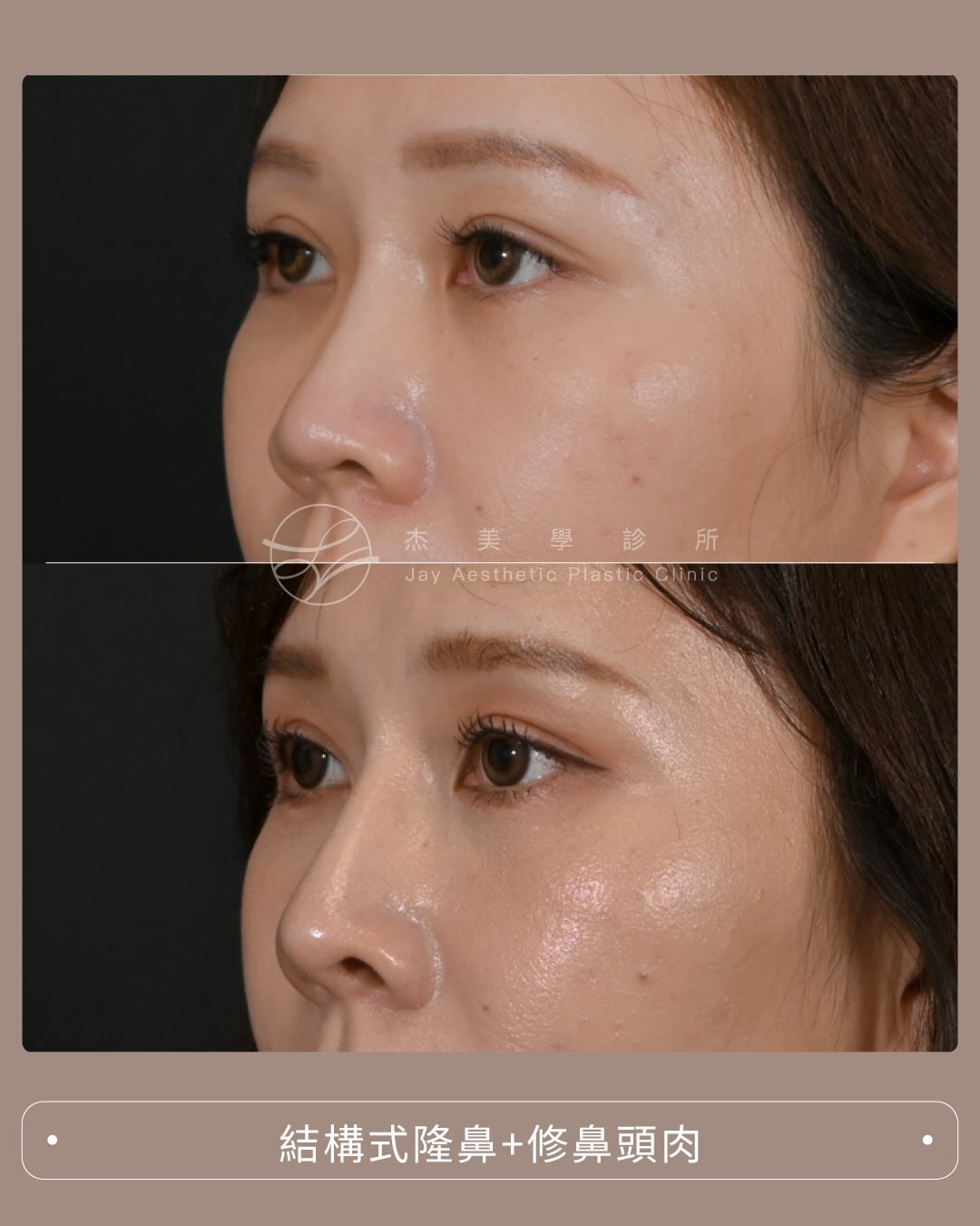 SaveClip.App_609204599_17950799133062937_514456197461232388_n