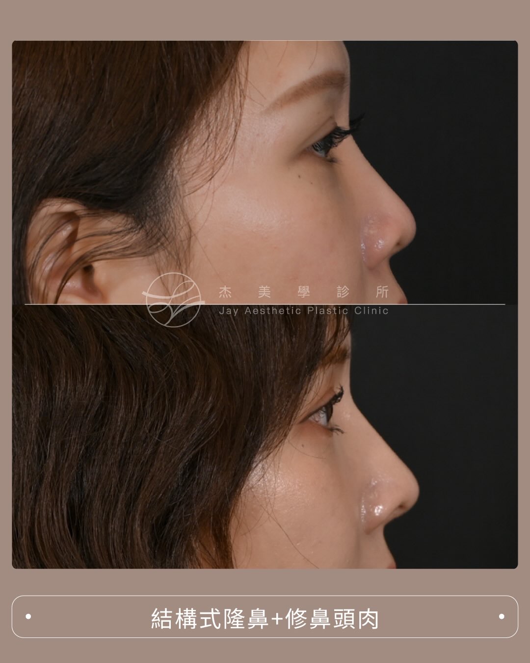 SaveClip.App_609561366_17951224827062937_192892313396260309_n