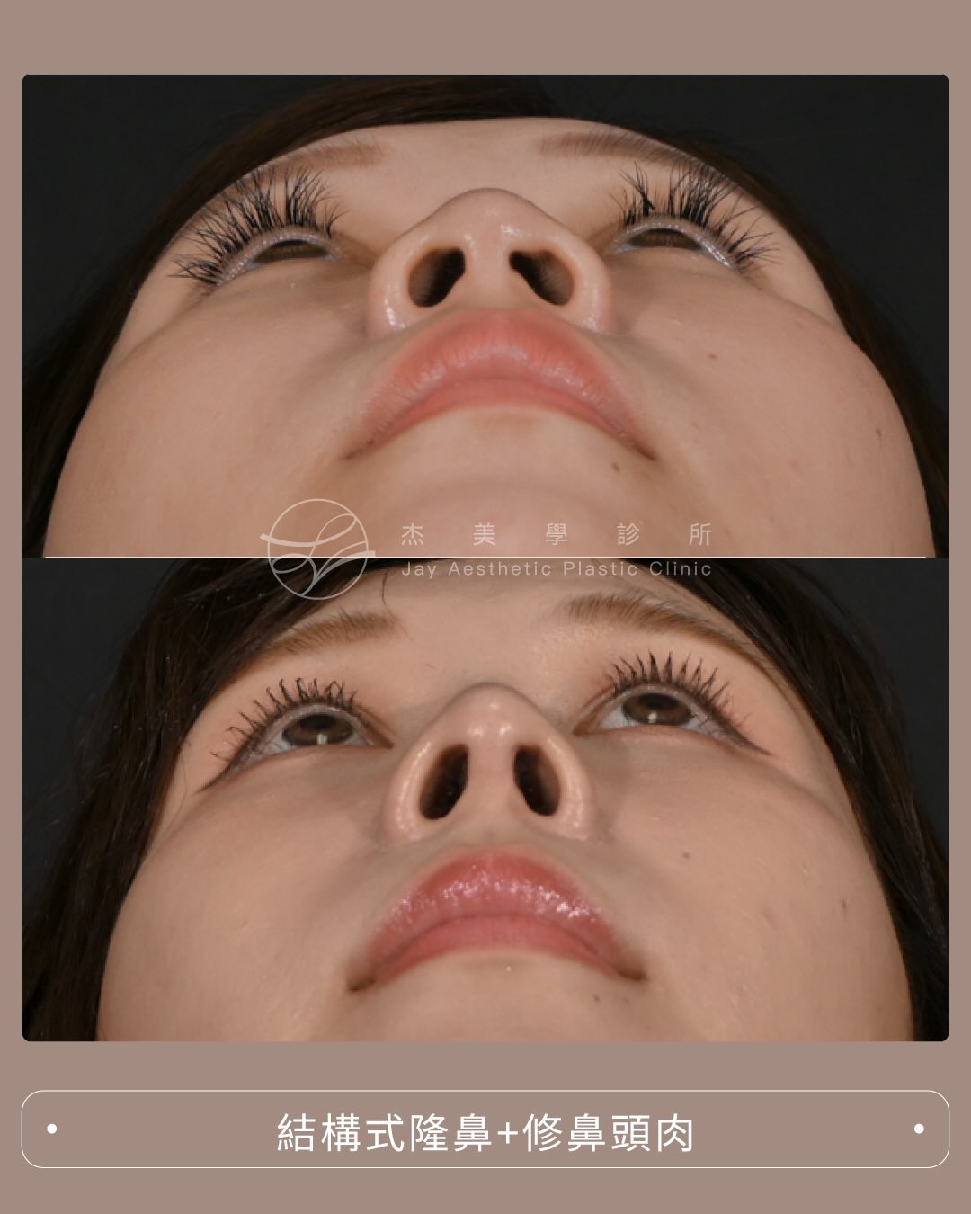 SaveClip.App_609950928_17951224833062937_5416316856074157486_n