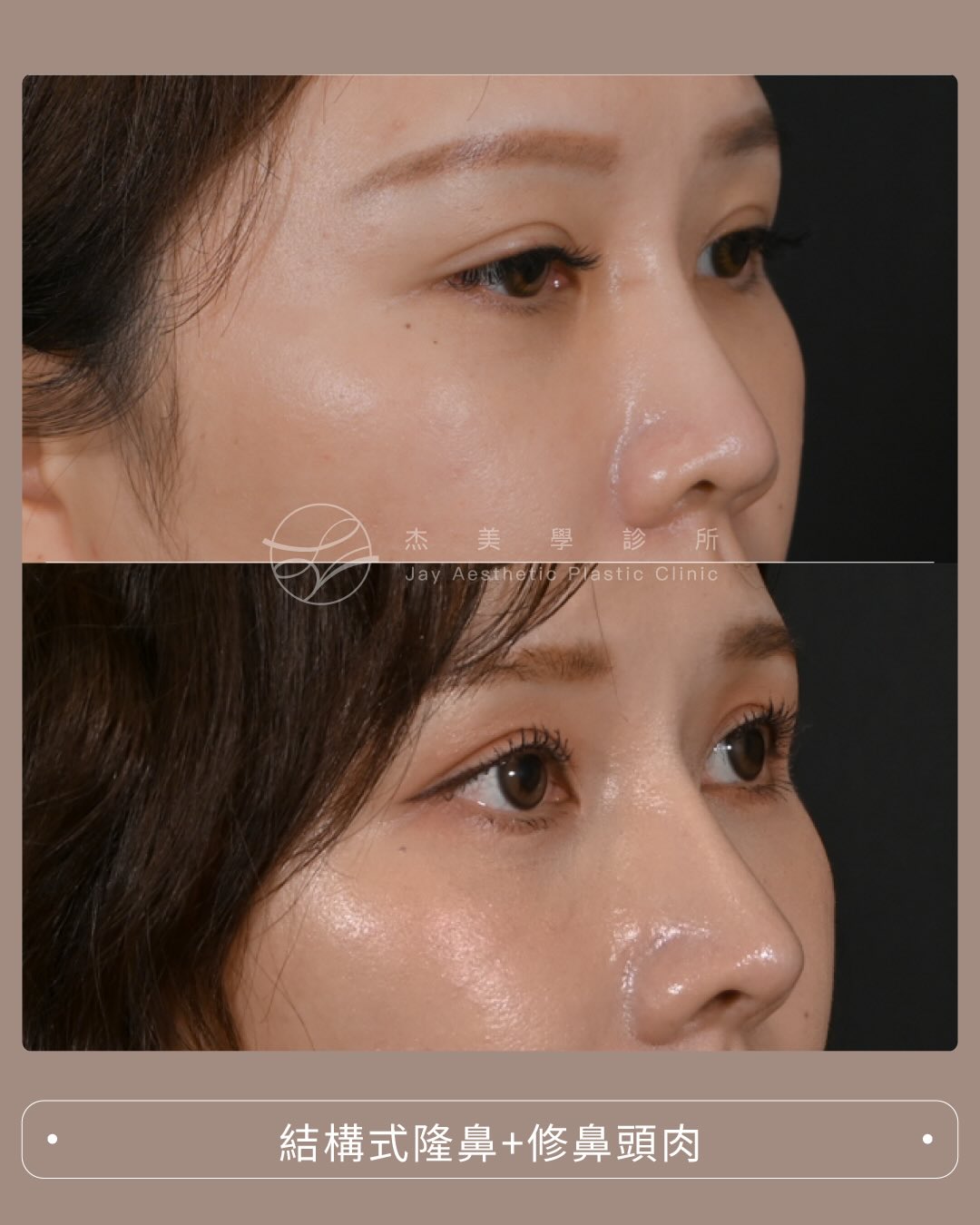 SaveClip.App_610559494_17951224824062937_4826525258325962259_n