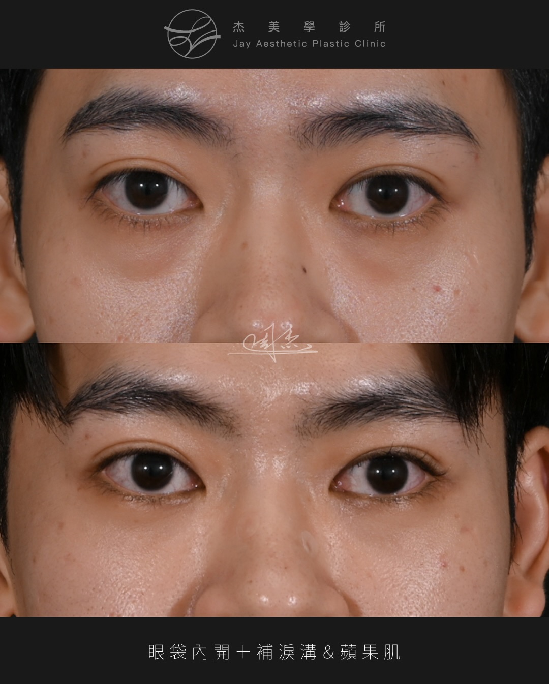 SaveClip.App_610879344_18357244822160158_7880981014610109040_n