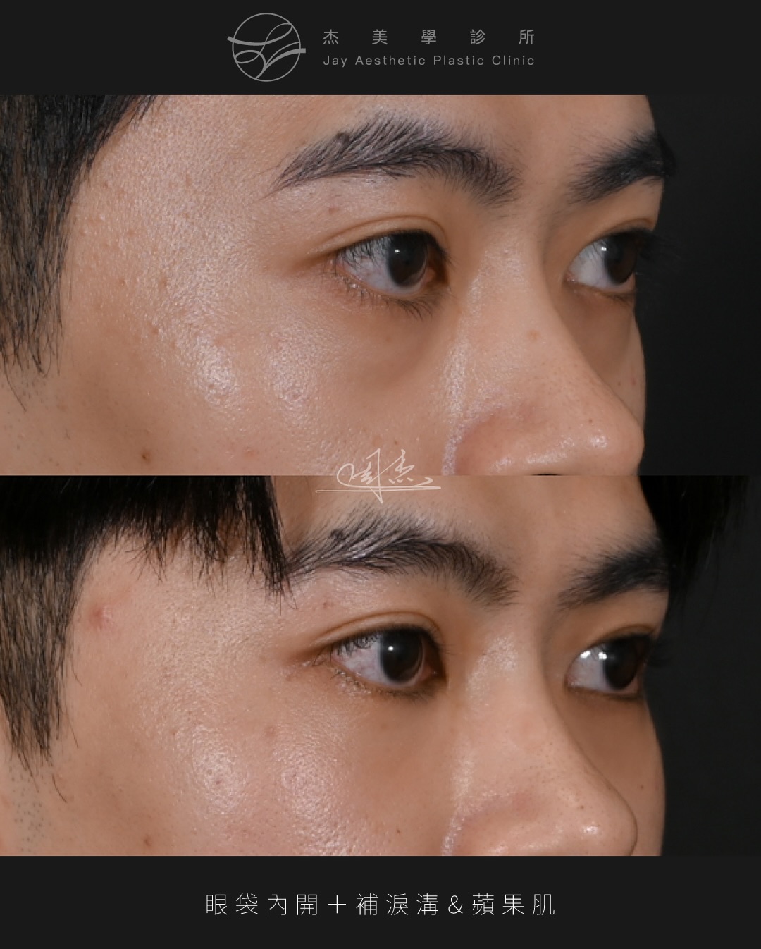 SaveClip.App_610882284_18357244858160158_5742253166206776947_n