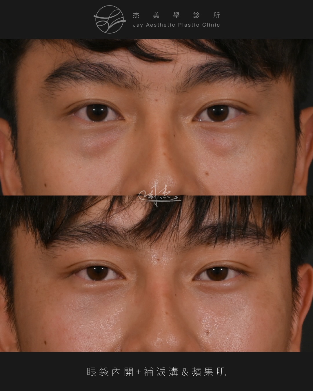 SaveClip.App_610892041_18356961883160158_5055200956904108179_n