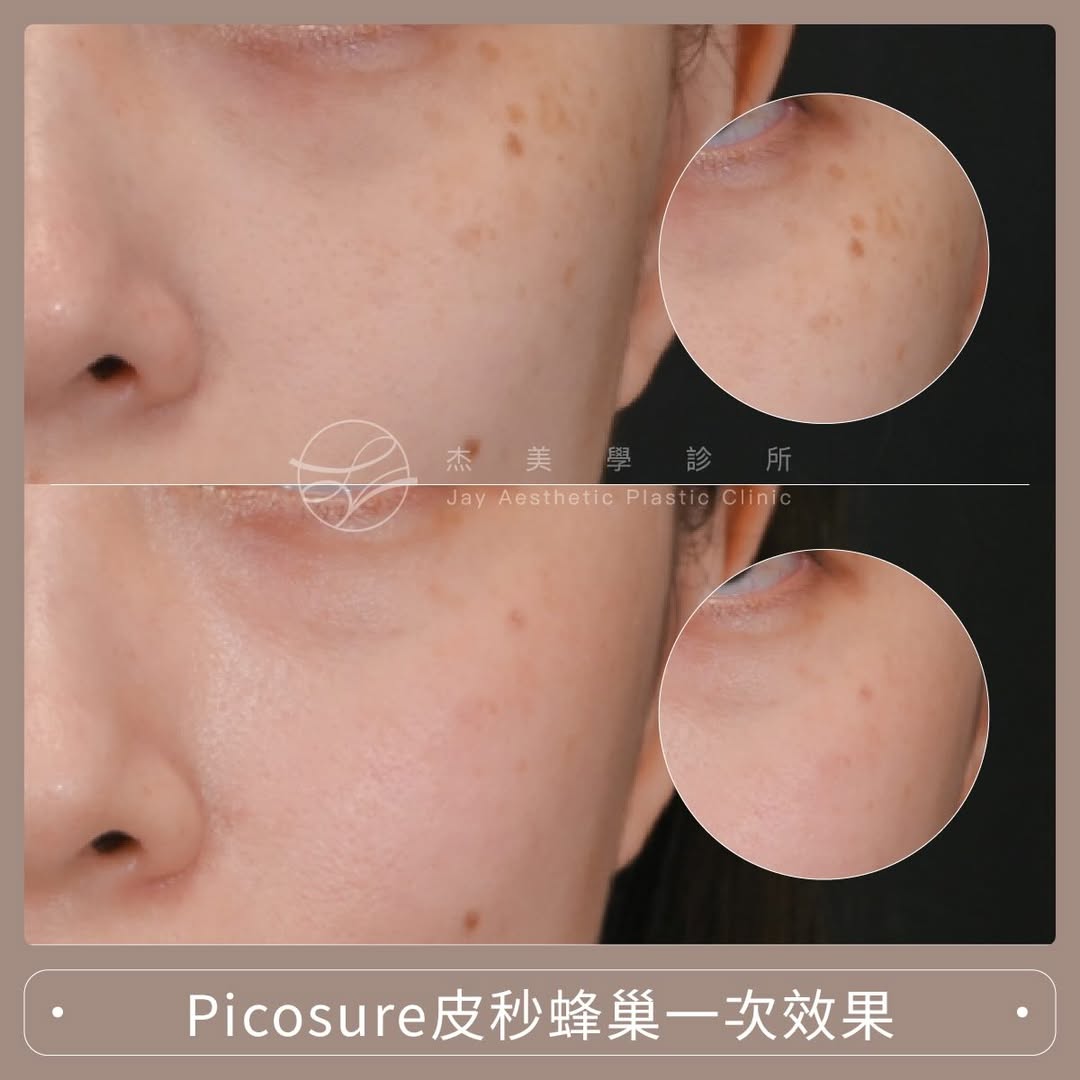 SaveClip.App_613760251_17952361668062937_607084215286067701_n