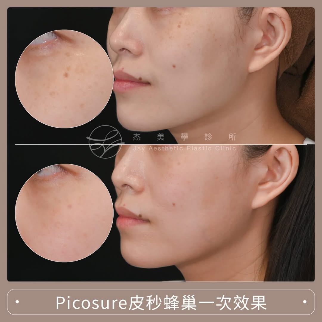 SaveClip.App_615268936_17952361677062937_4660922409244729269_n