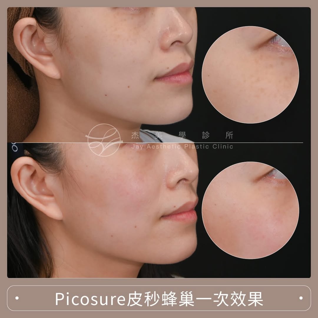 SaveClip.App_616249178_17952362154062937_5227151493157205872_n