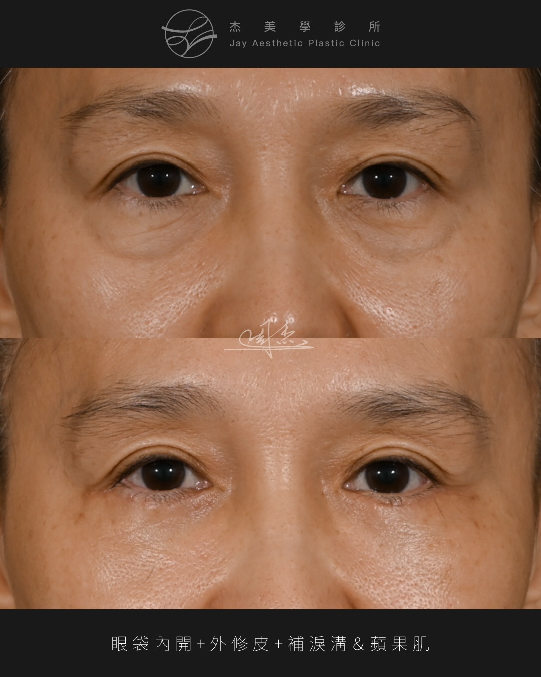 SaveClip.App_618697640_18358372204160158_5066306145228598689_n