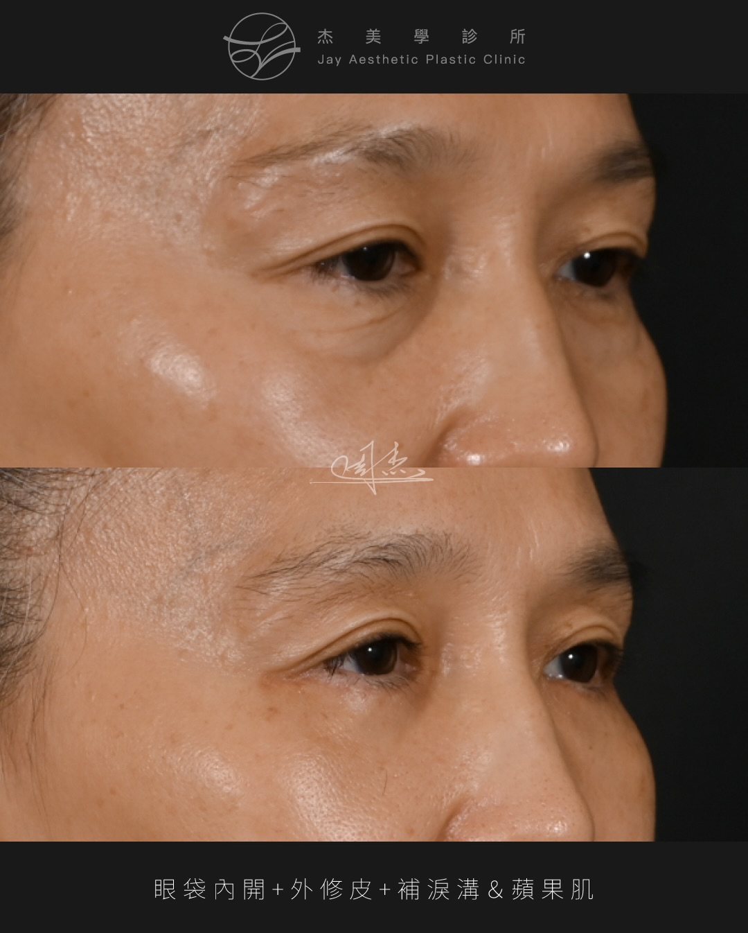 SaveClip.App_618717195_18358372222160158_1966254915589098452_n