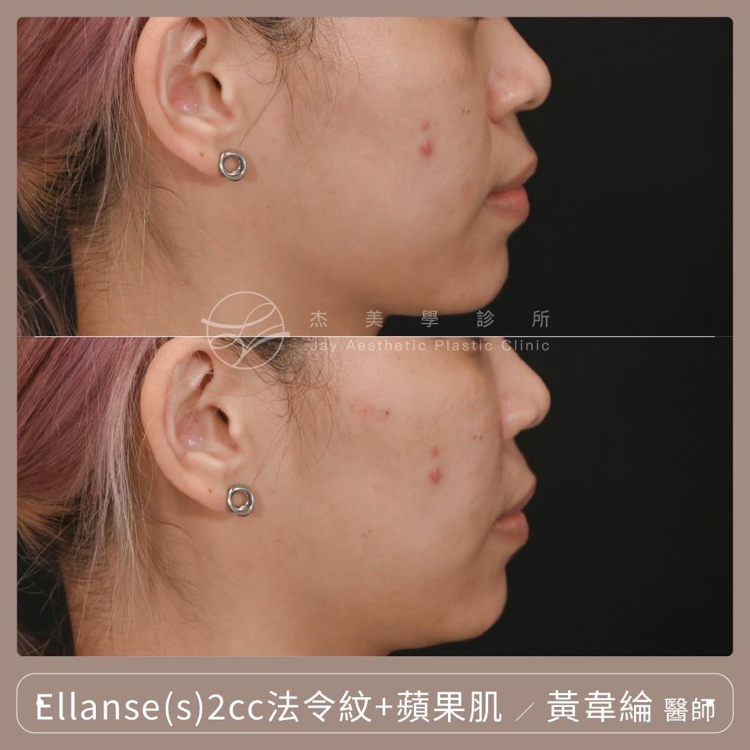 SaveClip.App_622458543_17953898562062937_6469111097987475782_n