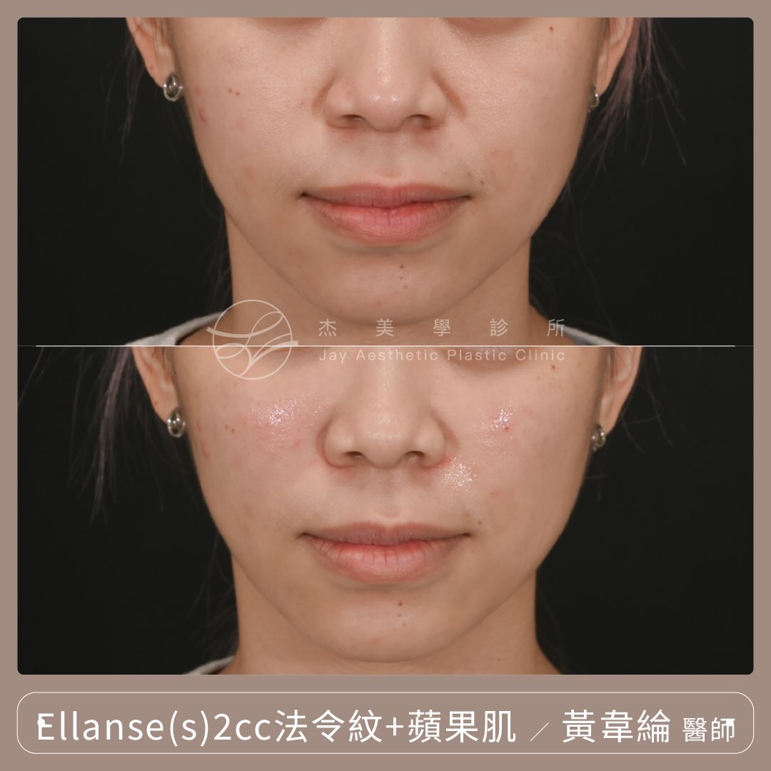 SaveClip.App_622480933_17953898451062937_6563797898261029890_n