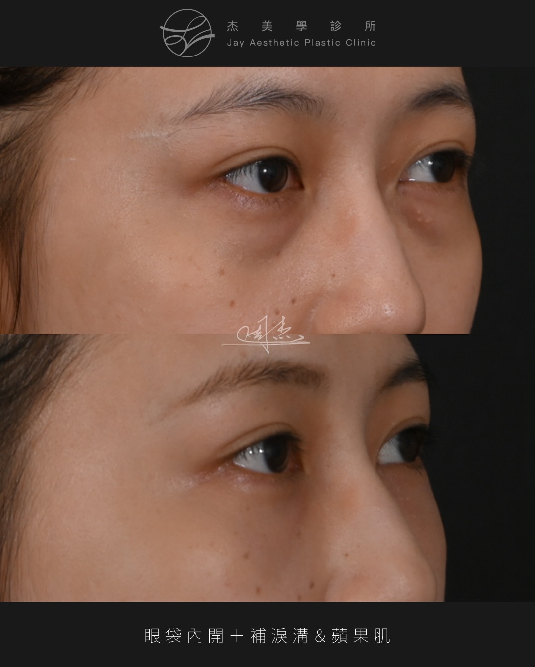 SaveClip.App_622484128_18359794390160158_2047187178887115141_n