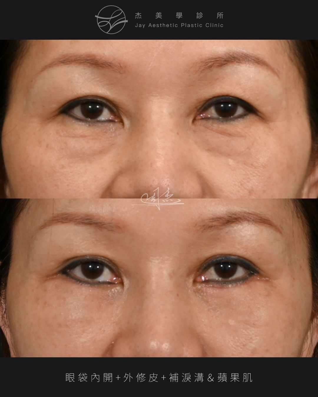 SaveClip.App_622501574_18359526826160158_8654068137240704669_n