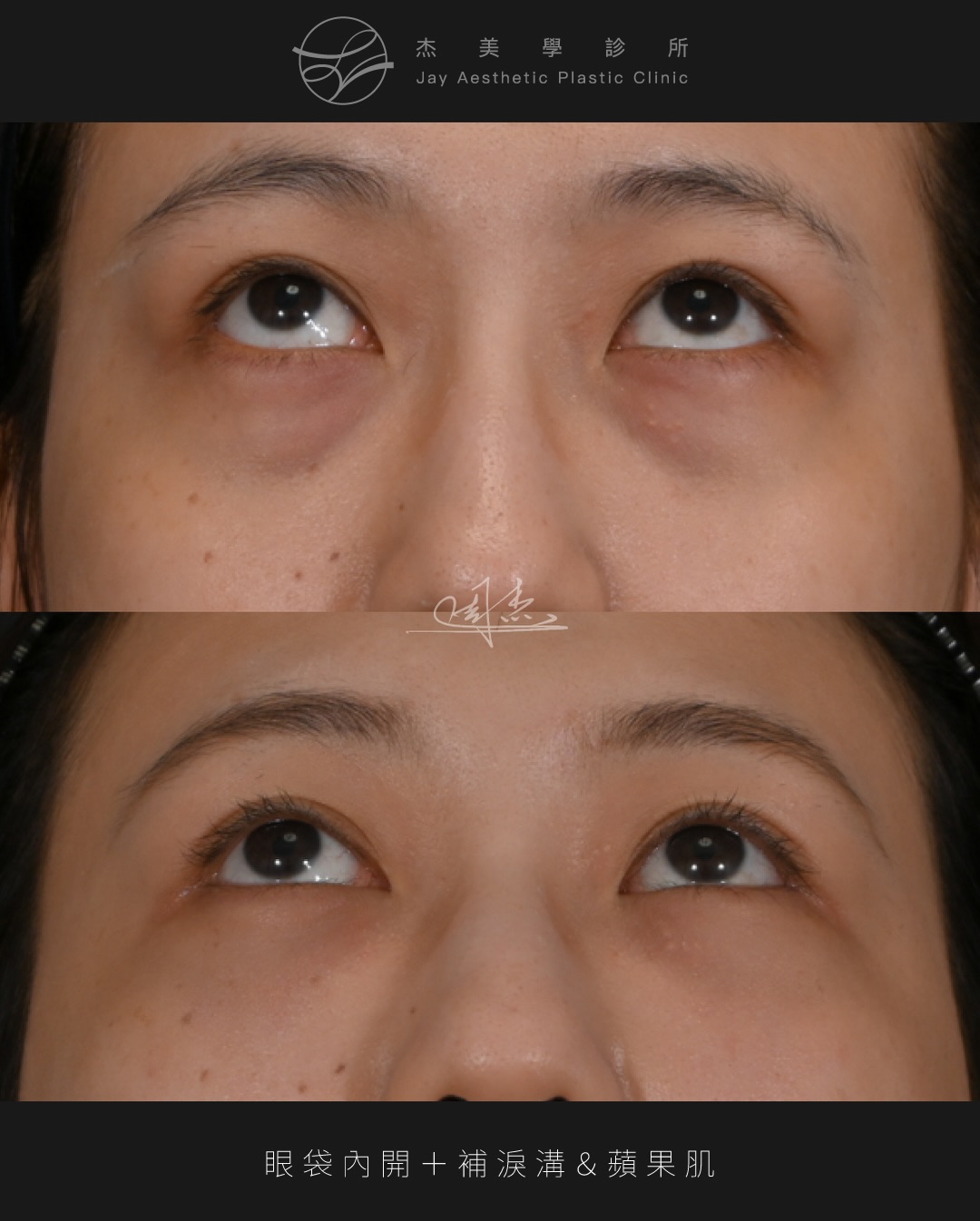 SaveClip.App_622611068_18359794363160158_7749977165613757218_n