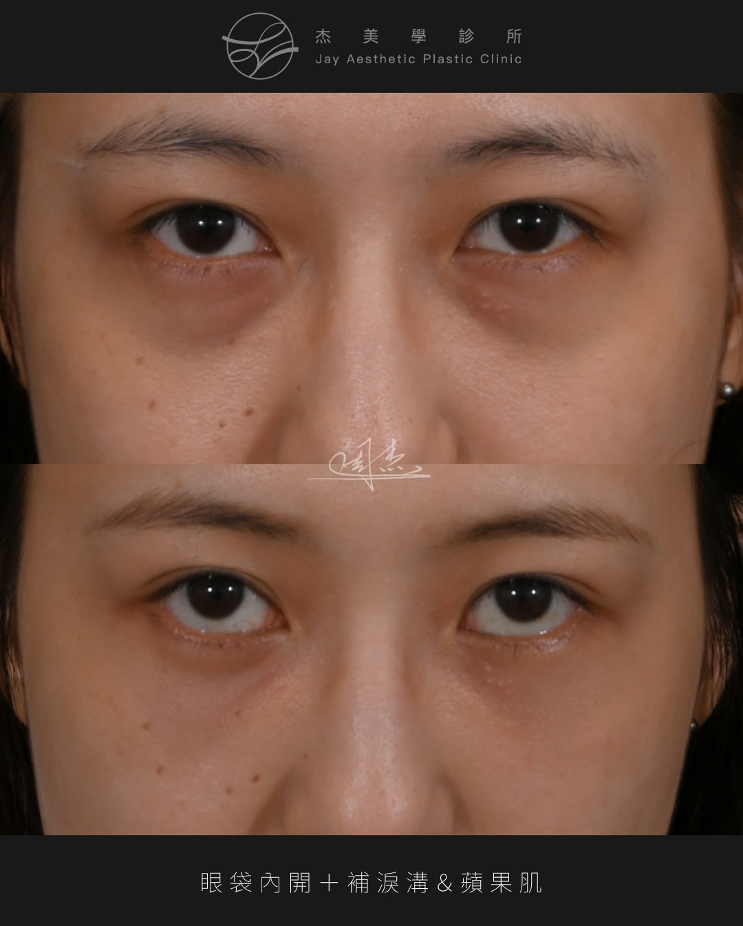 SaveClip.App_624275344_18359794372160158_495673428166119065_n