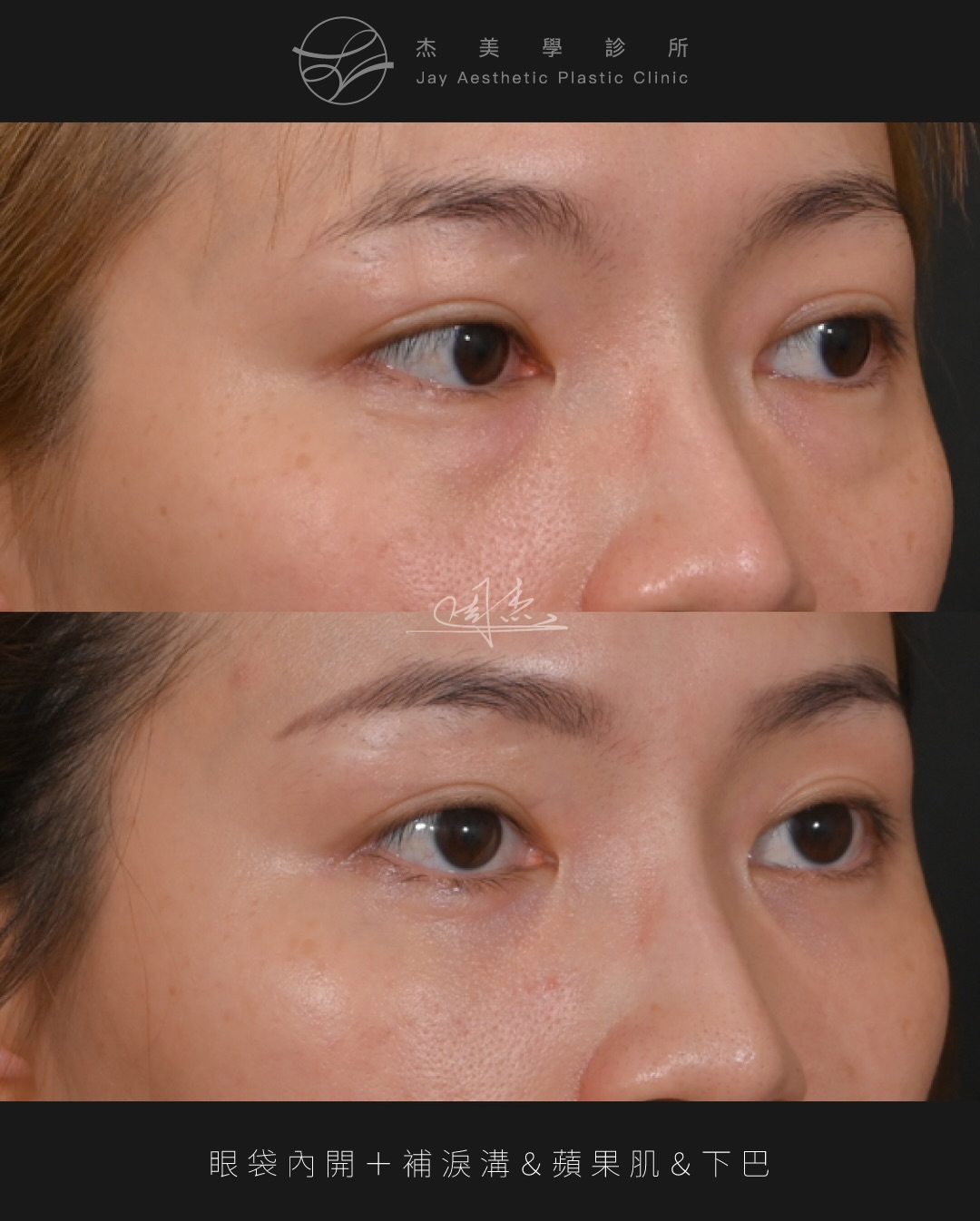 SaveClip.App_626419499_18360795226160158_6035965848569833410_n