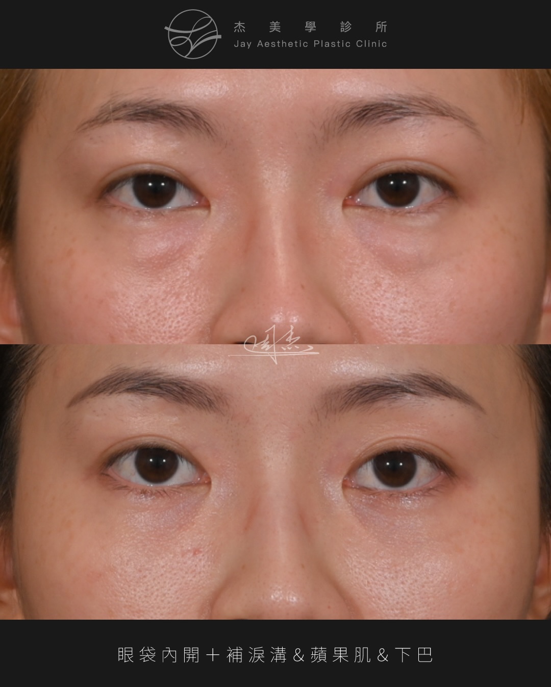 SaveClip.App_627210539_18360795172160158_7965773748409470292_n