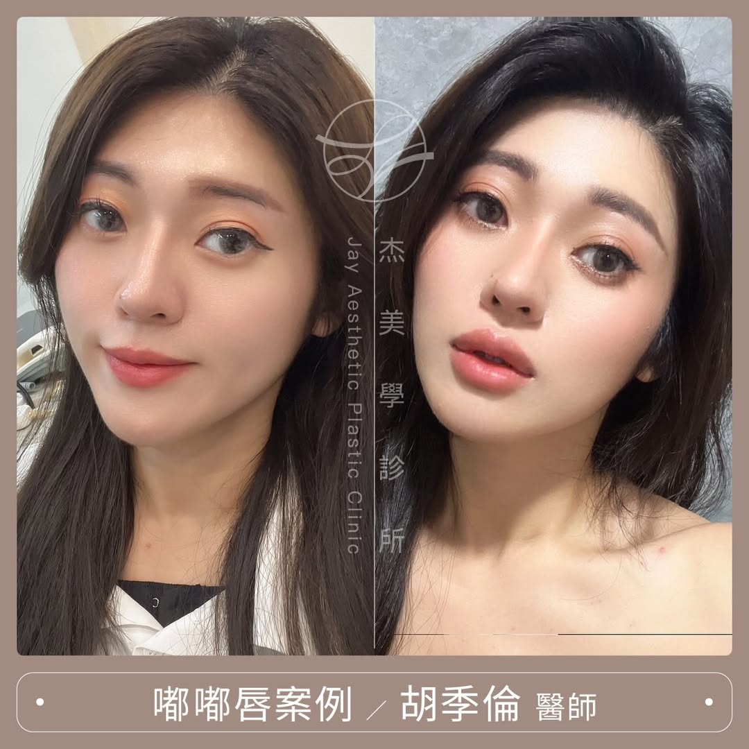 SaveClip.App_627511240_17954571084062937_5286006954355641778_n