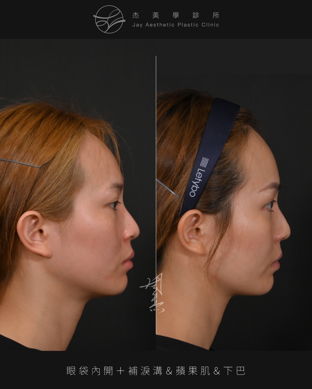 SaveClip.App_627642120_18360795208160158_1989974323120831625_n