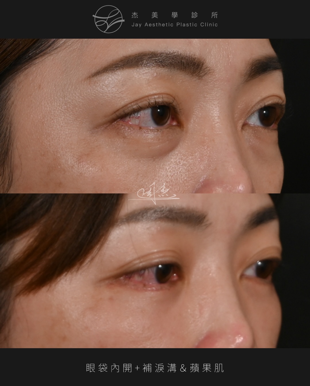 SaveClip.App_632462878_18363104692160158_4744818850644645514_n