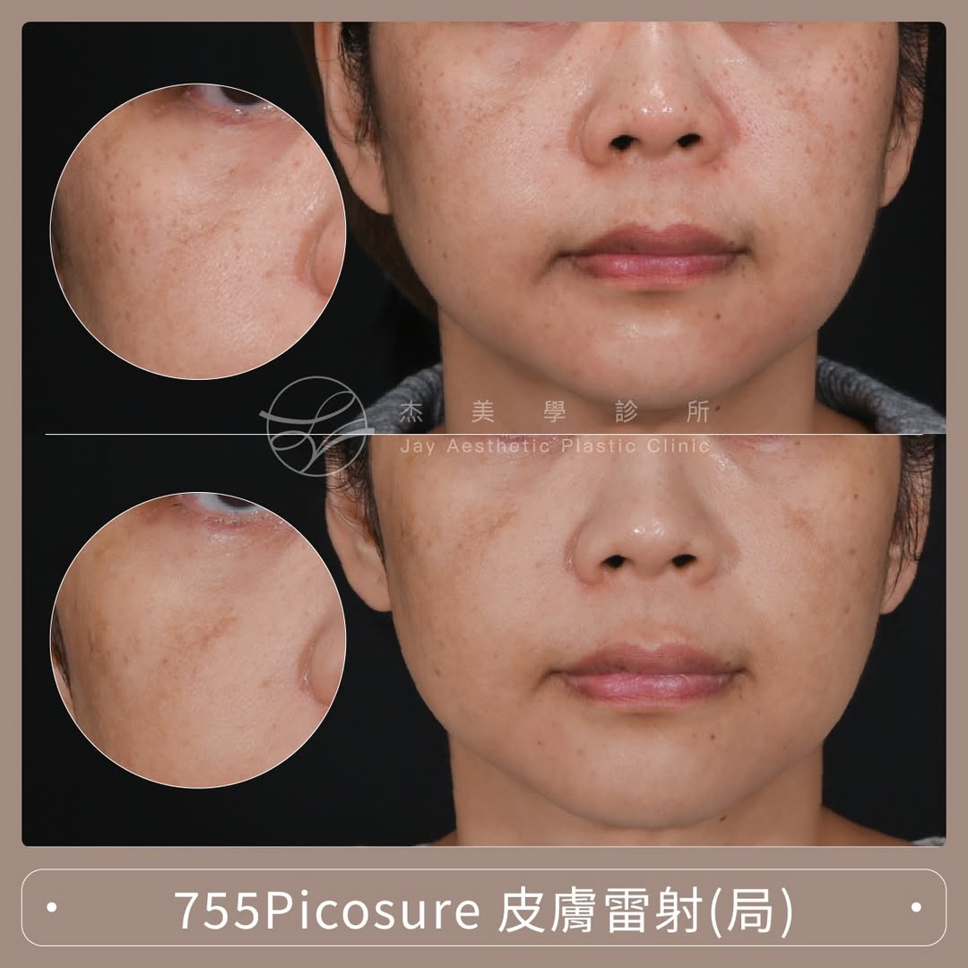 SaveClip.App_642460145_17957693781062937_2230943677613120197_n