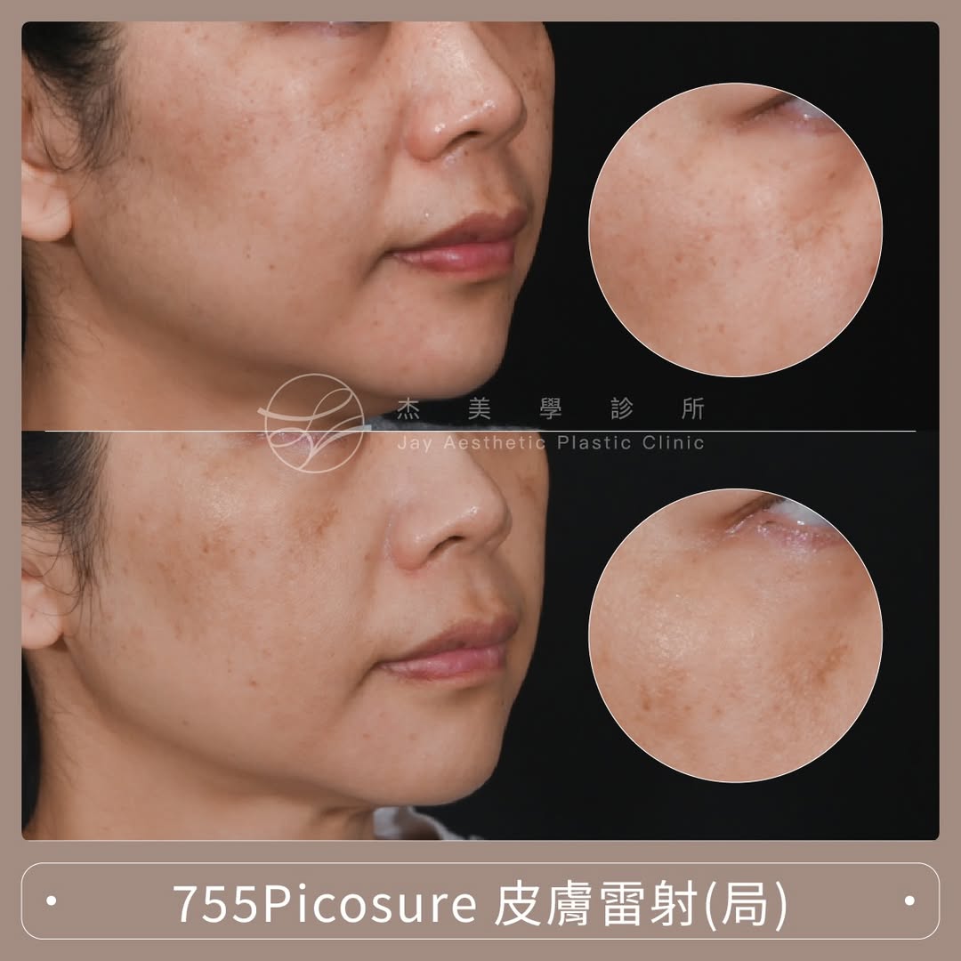 SaveClip.App_643589710_17957693808062937_2459783435988039186_n