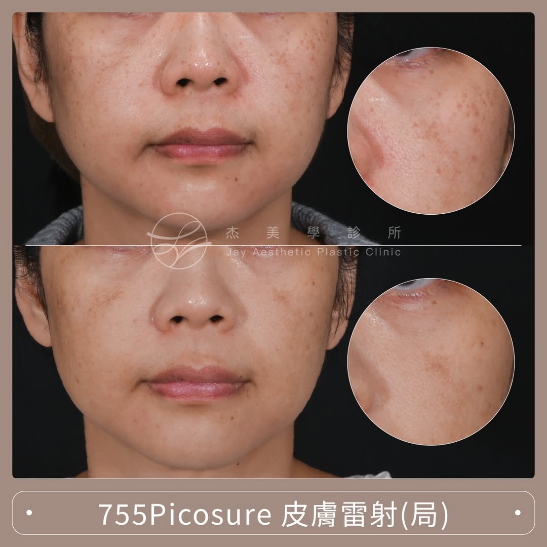 SaveClip.App_645591009_17957693796062937_6014994171562707051_n