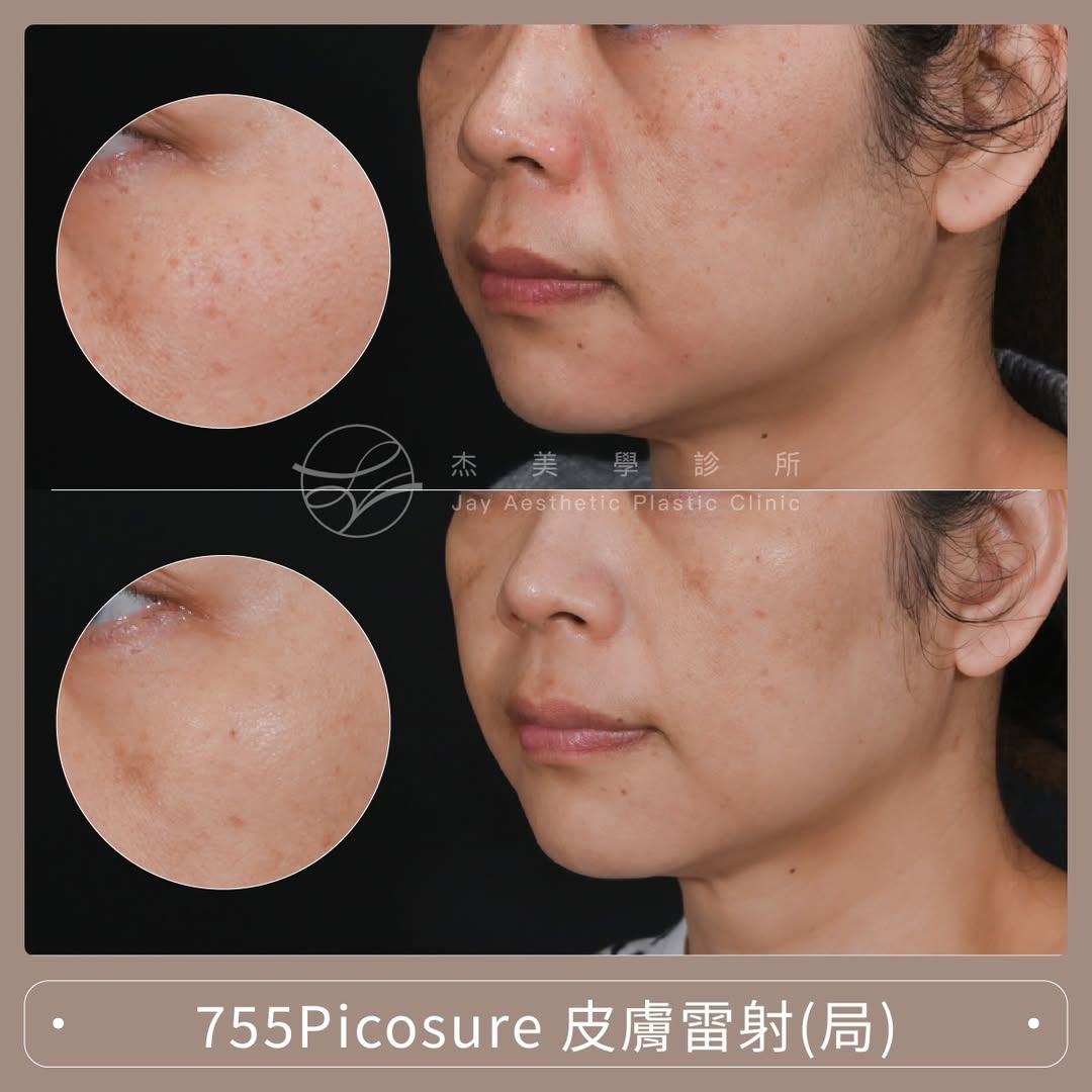 SaveClip.App_645745426_17957693799062937_7249101132671652878_n