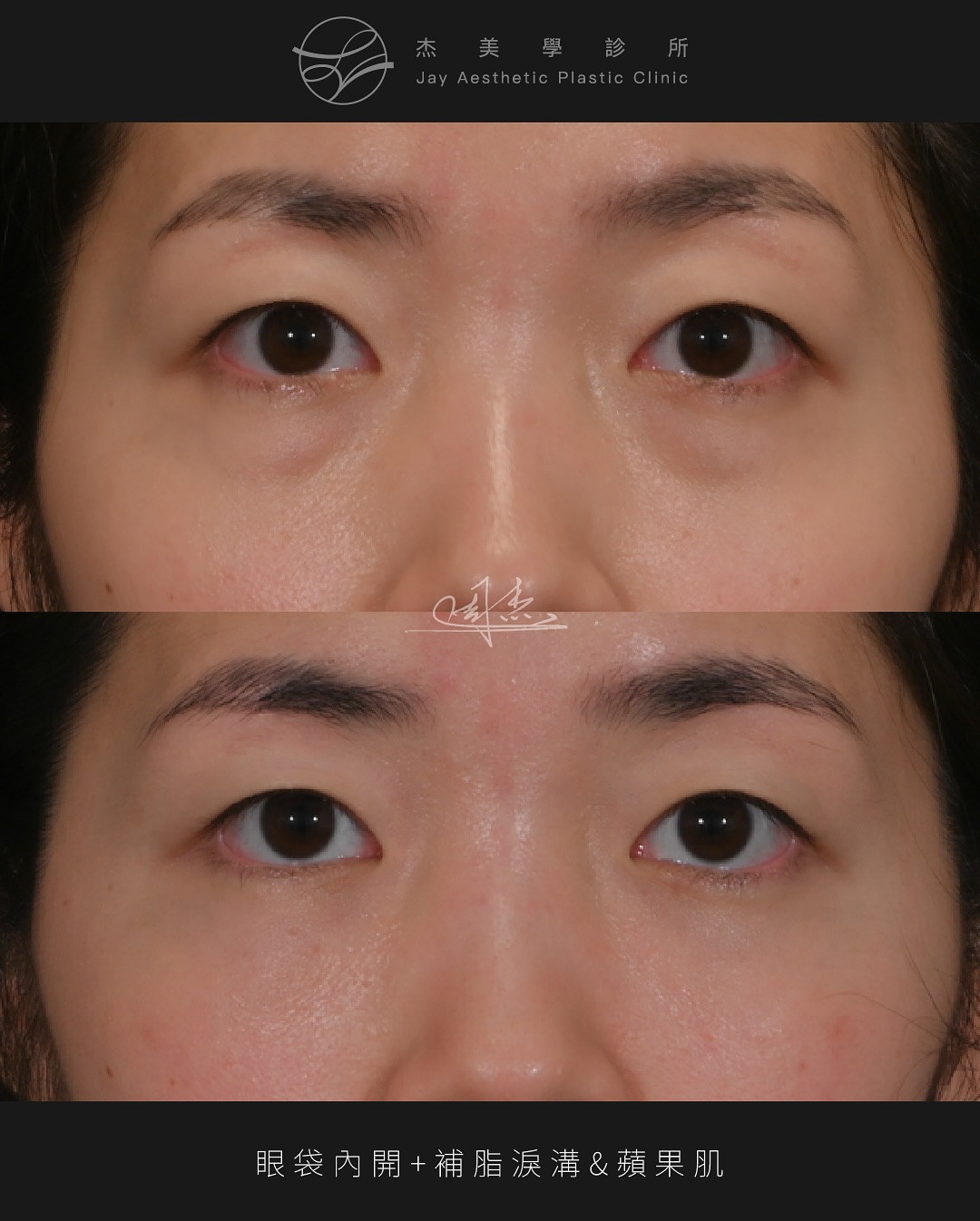 SnapInsta.to_503433396_18333385231160158_4203534460476785516_n