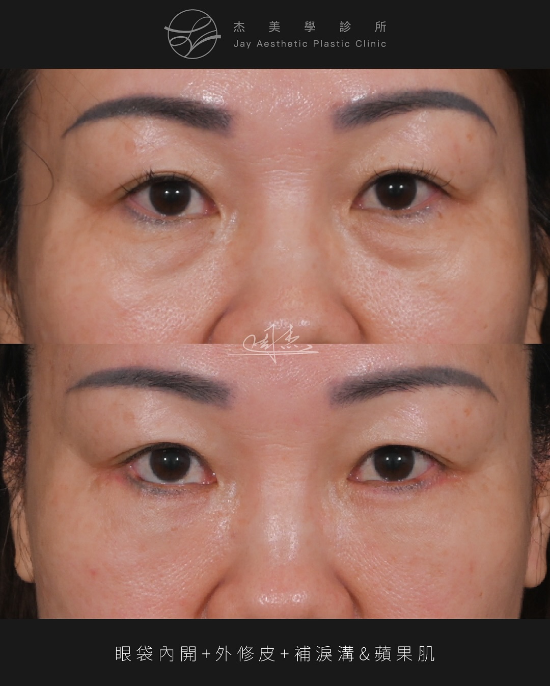 SnapInsta.to_514519480_18334518364160158_3457406976574682597_n