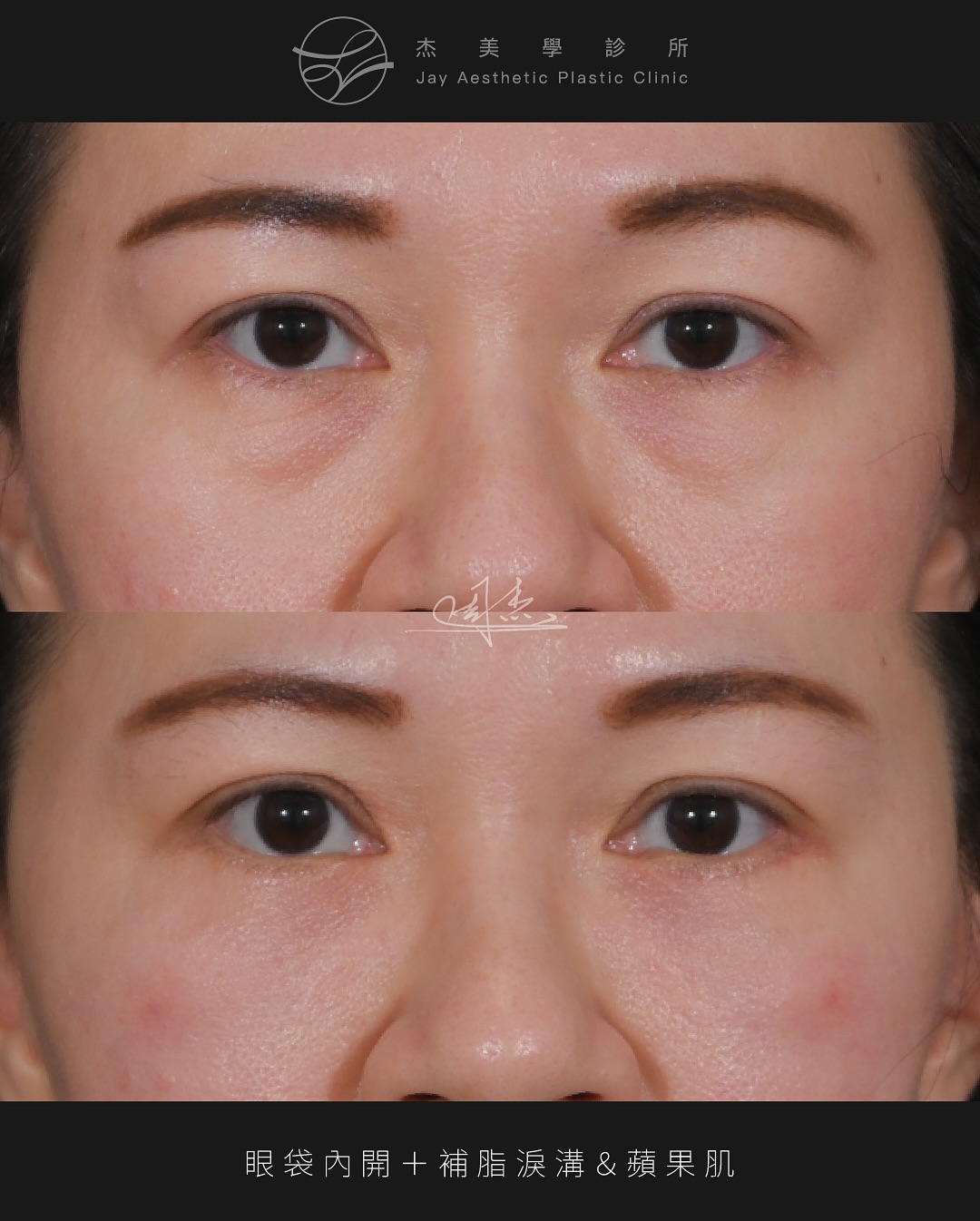 SnapInsta.to_514703440_18334716343160158_6508229159753873254_n