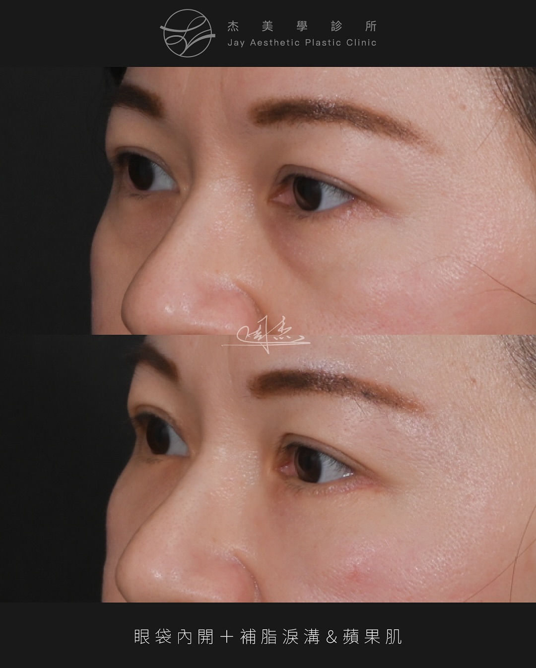 SnapInsta.to_515088746_18334716361160158_3931079584210236683_n