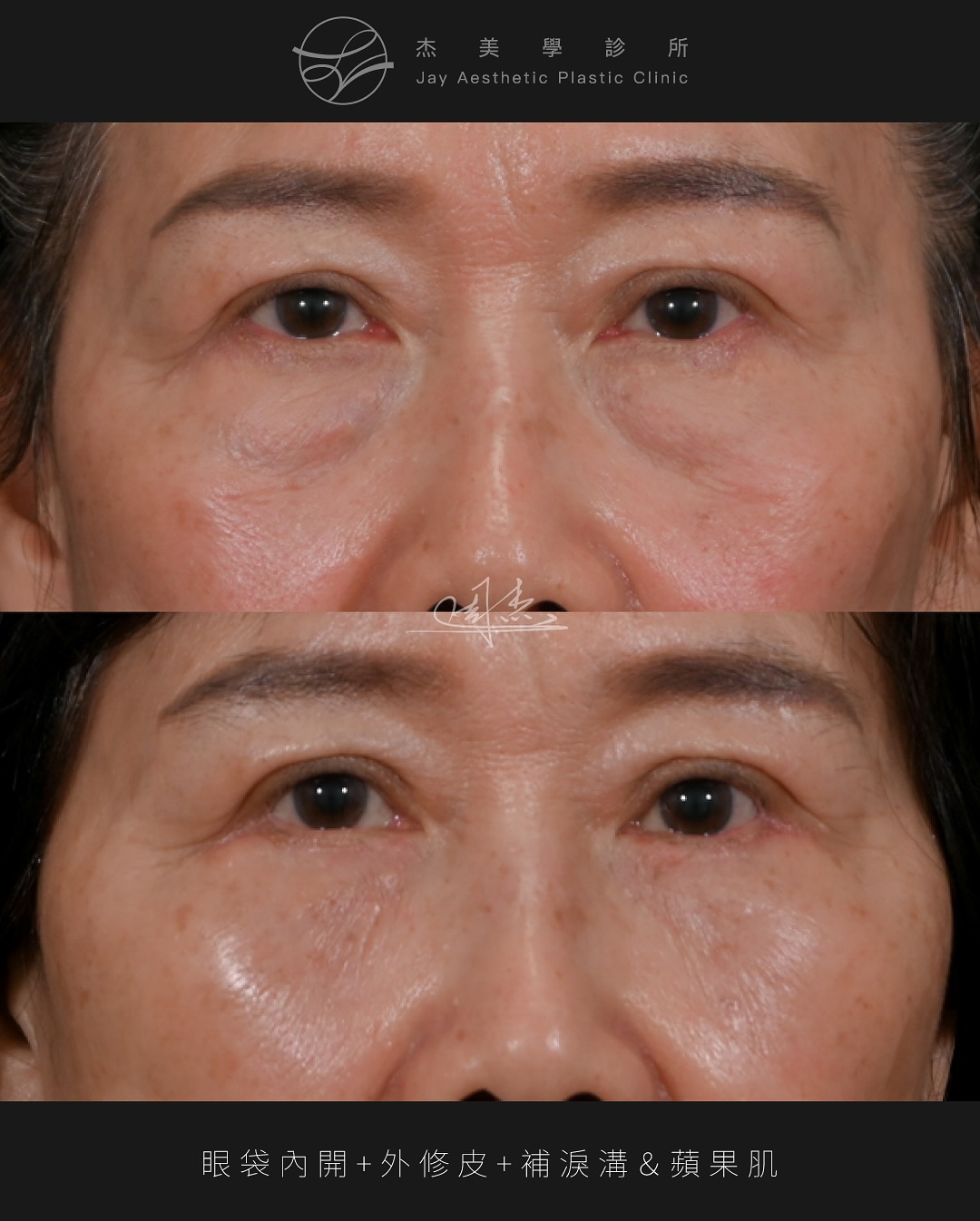 SnapInsta.to_517258845_18335602843160158_2013325304371181955_n