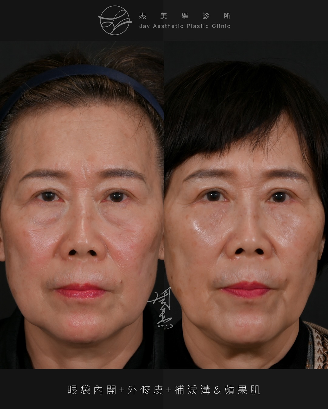 SnapInsta.to_517587175_18335602873160158_2026645552898583187_n