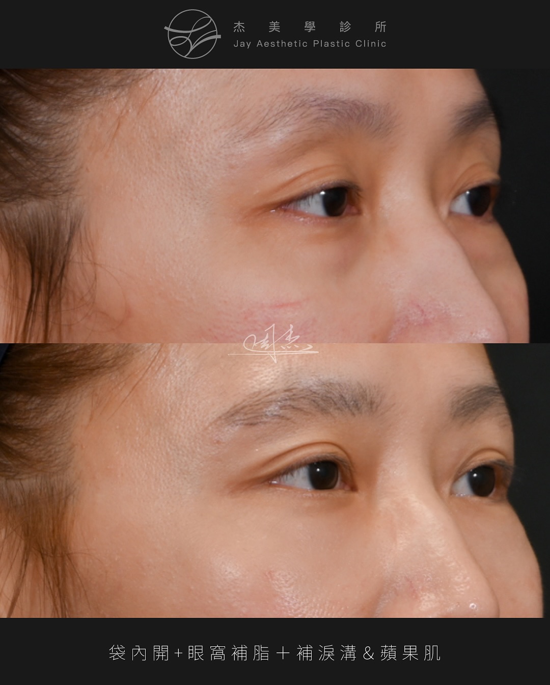 SnapInsta.to_518755438_18336000445160158_7233272761190467511_n