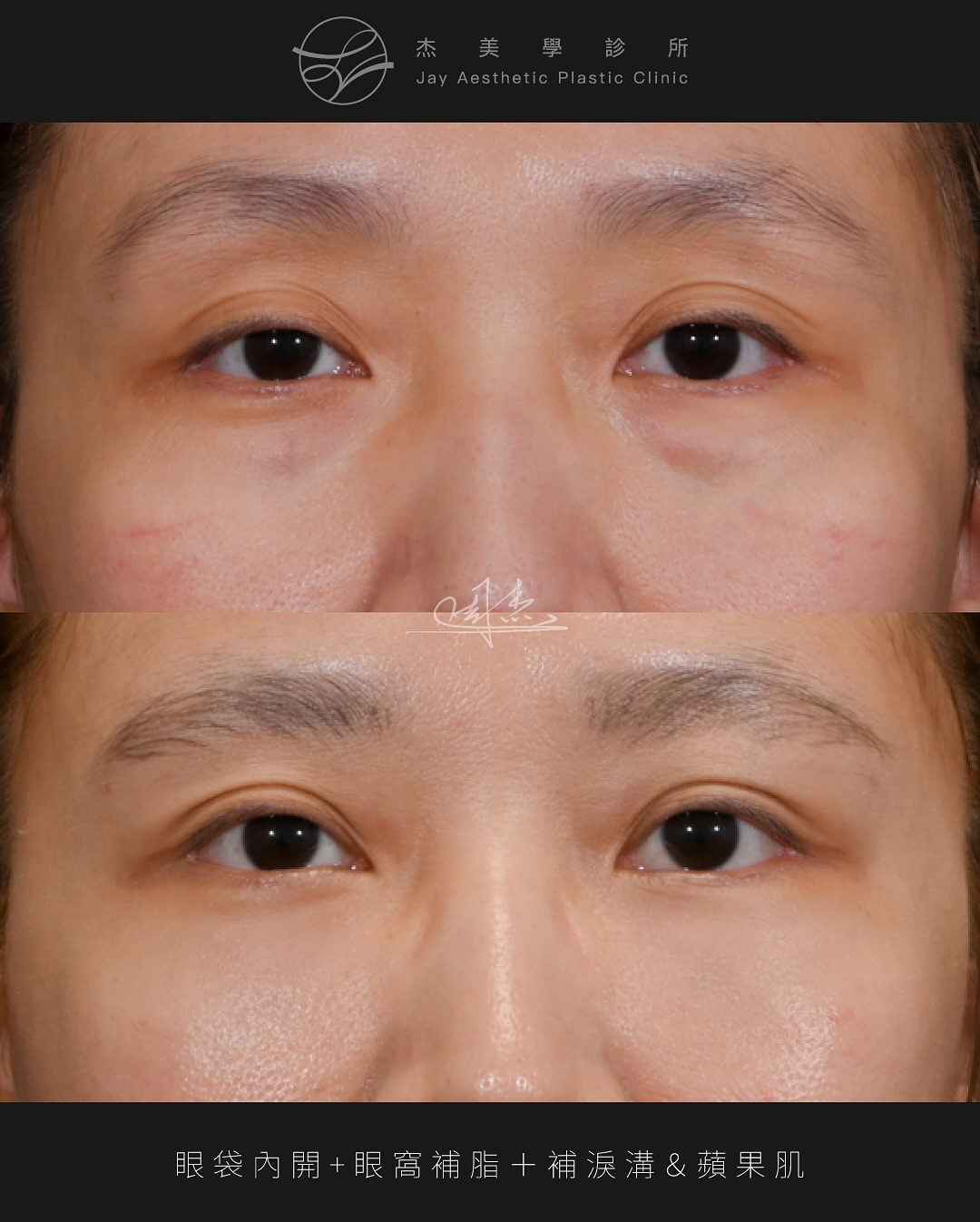 SnapInsta.to_520525159_18336000415160158_4354324712847131565_n