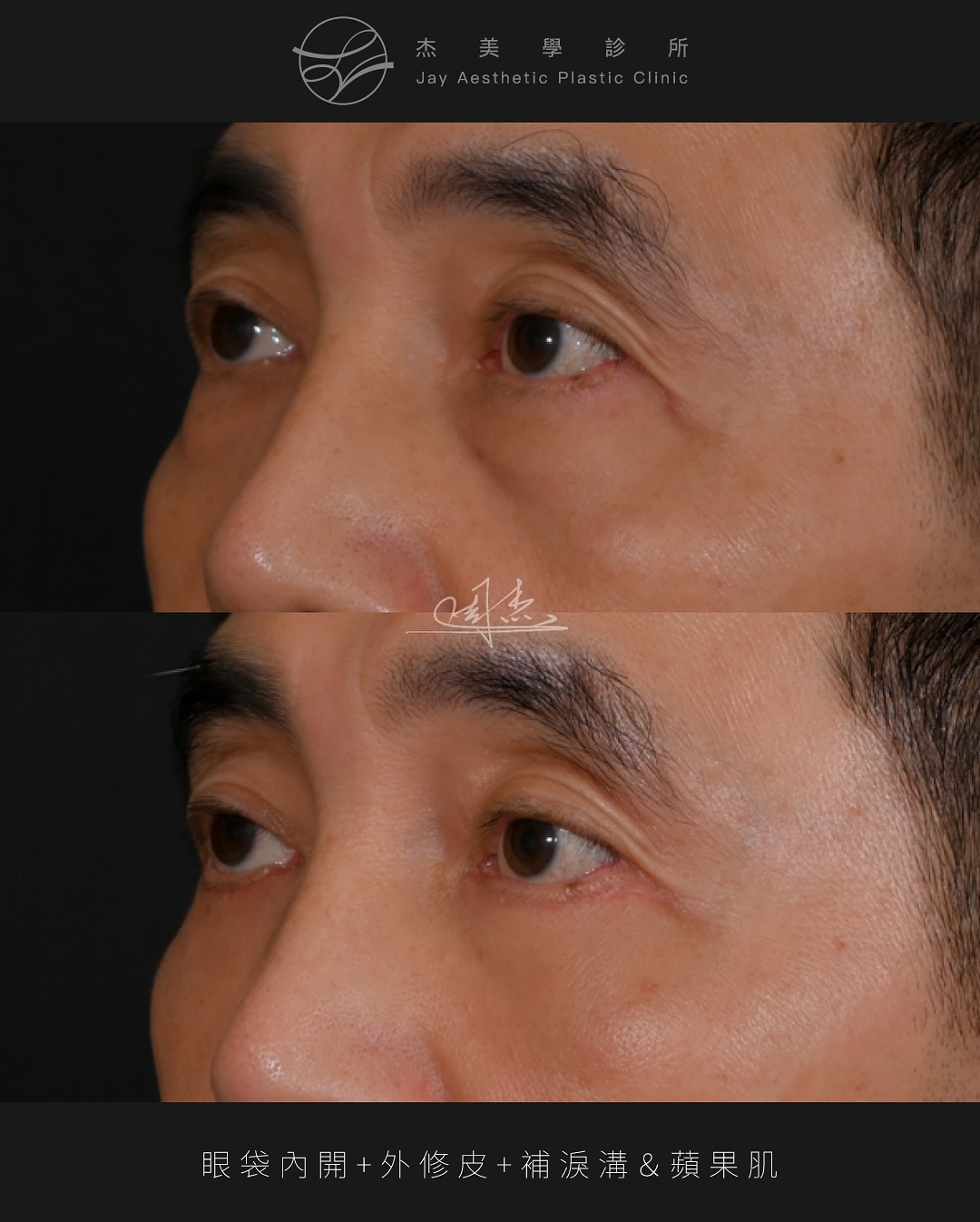 SnapInsta.to_525349789_18337398055160158_2827401345387907992_n