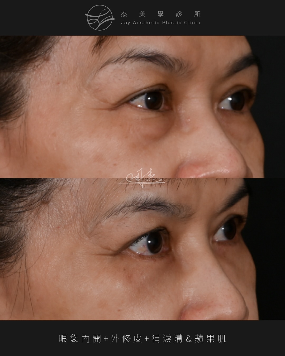 SnapInsta.to_529890540_18338650897160158_6631947272446220229_n