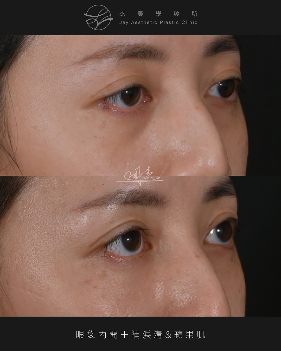 SnapInsta.to_537334232_18339950434160158_4656460199652160384_n