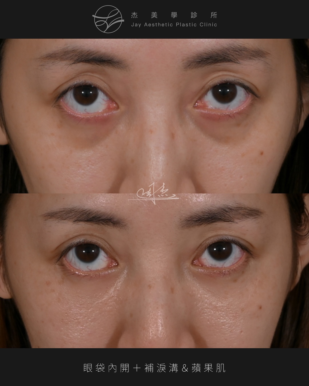 SnapInsta.to_537613199_18339950422160158_6390528701426132310_n