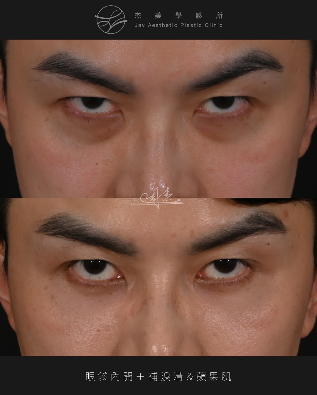 SnapInsta.to_539627812_18340580722160158_379442558287767432_n