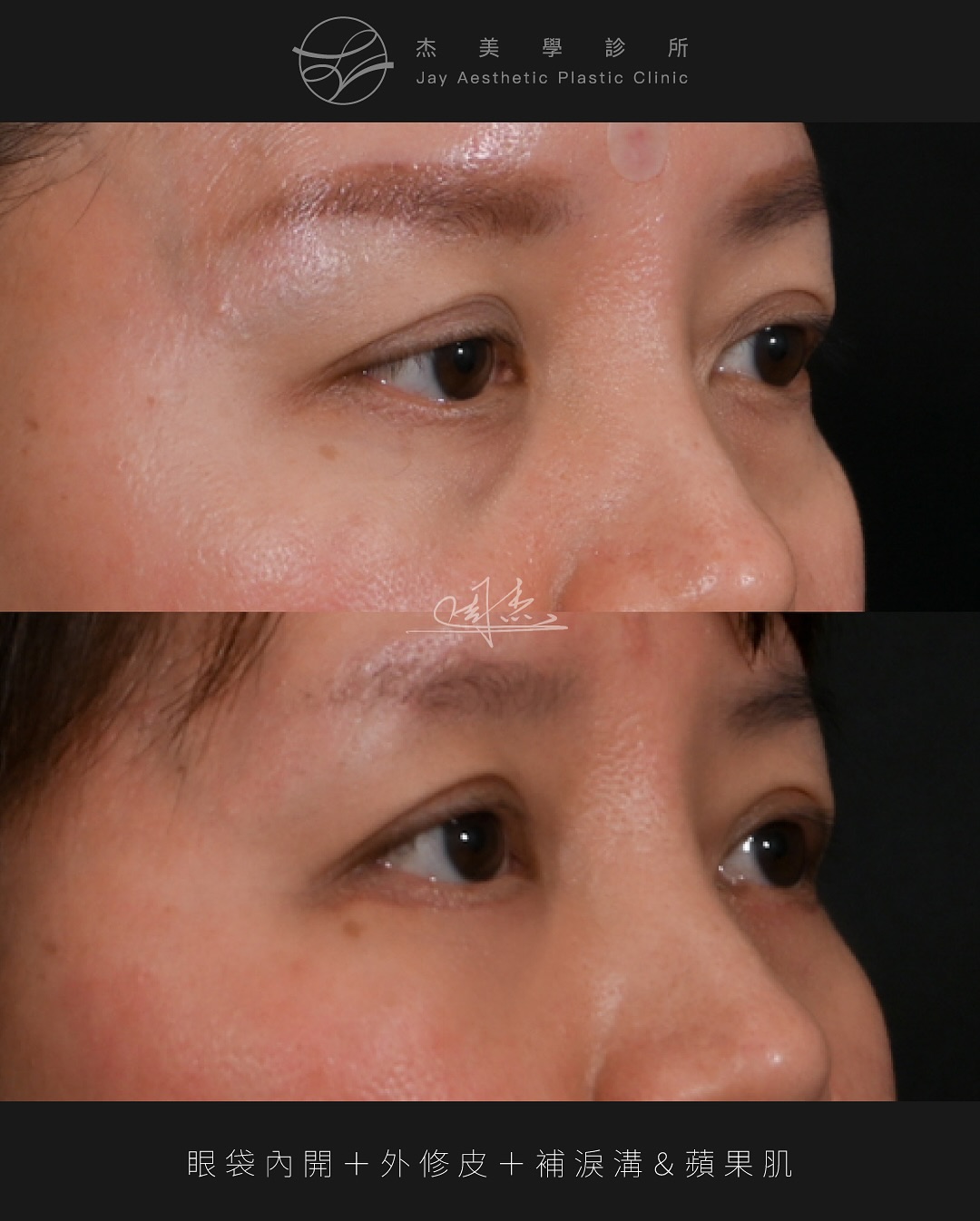 SnapInsta.to_539794287_18340228537160158_8617931120308180771_n