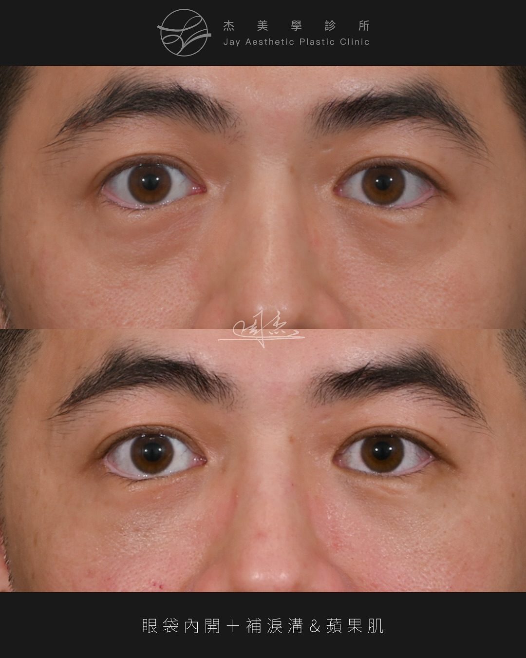 SnapInsta.to_542229676_18341111230160158_4779614830714483448_n