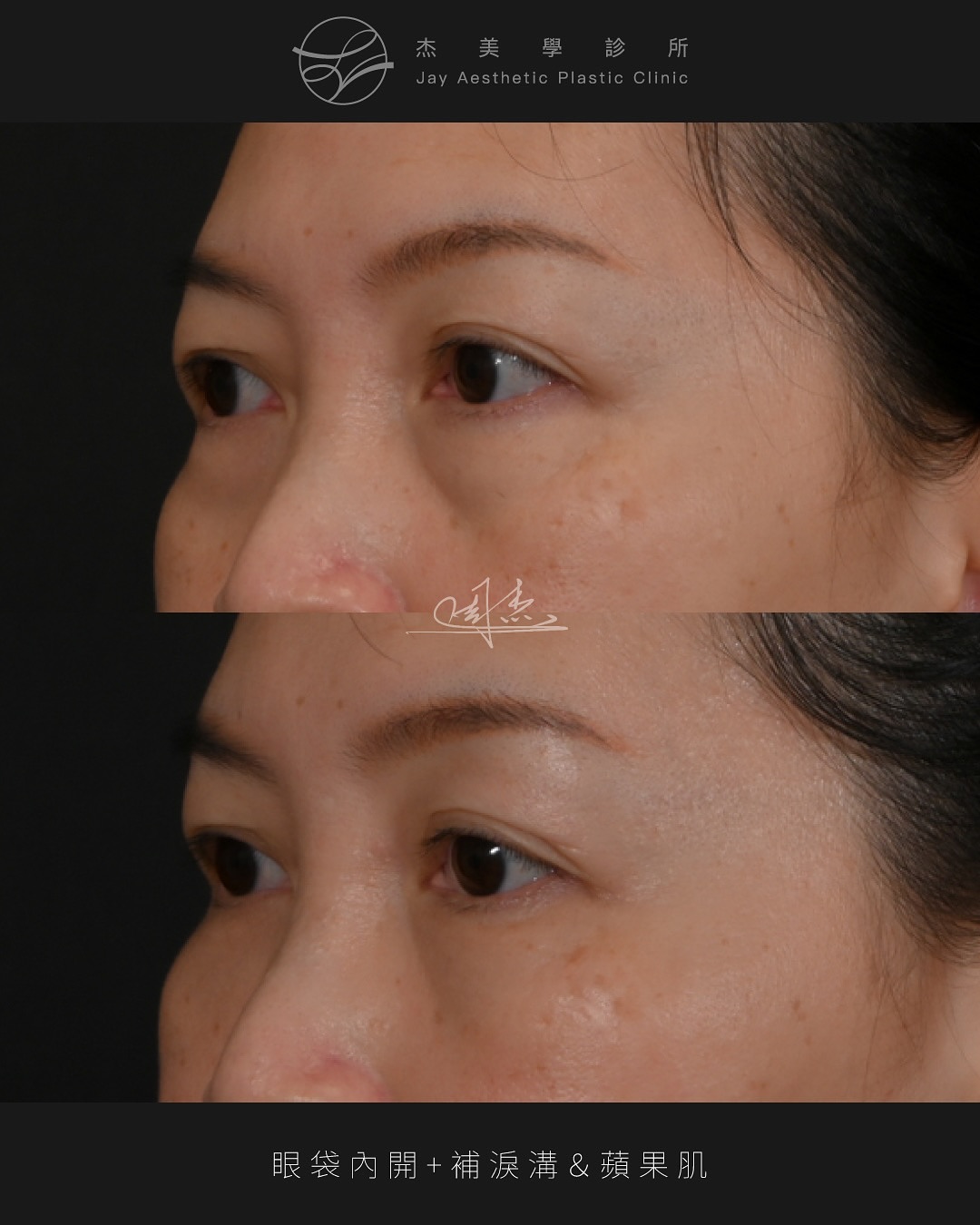 SnapInsta.to_550203162_18342708733160158_6942875227187509671_n