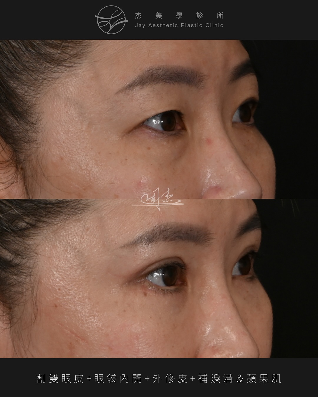 SnapInsta.to_551851493_18343439335160158_6903958439816341928_n