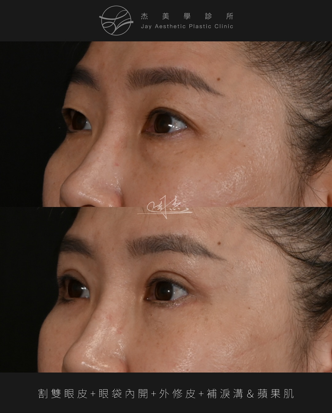 SnapInsta.to_553507896_18343439332160158_189347996438296645_n