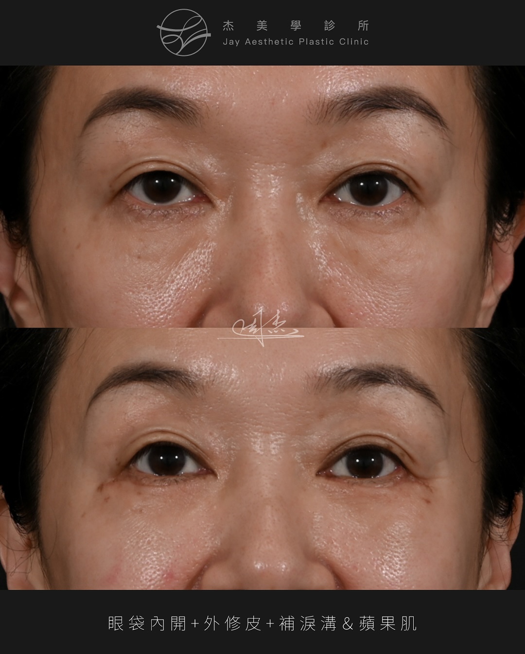 SnapInsta.to_554711515_18343851547160158_7362348096490231473_n