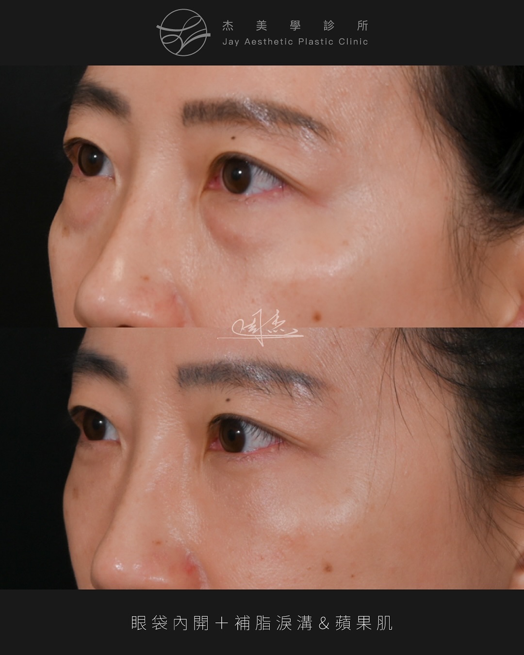 SnapInsta.to_557545499_18344847379160158_6399624645377475222_n