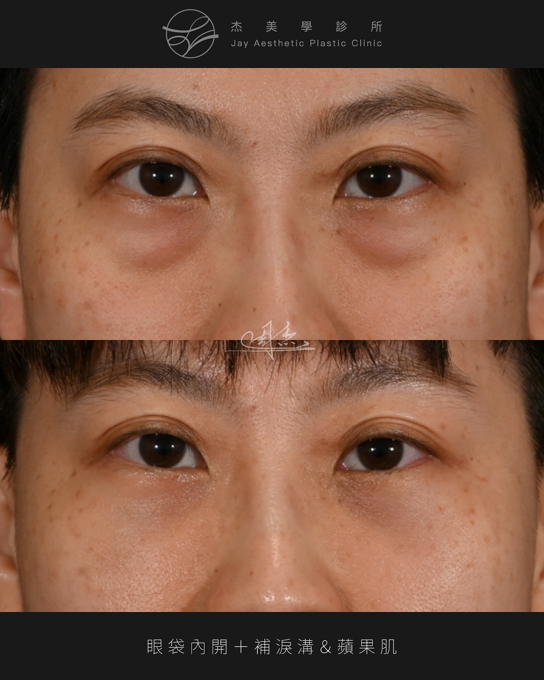 SnapInsta.to_568766763_18348024484160158_2725899651215594635_n