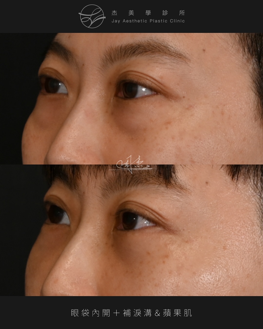 SnapInsta.to_568947343_18348024511160158_4405400809400216297_n